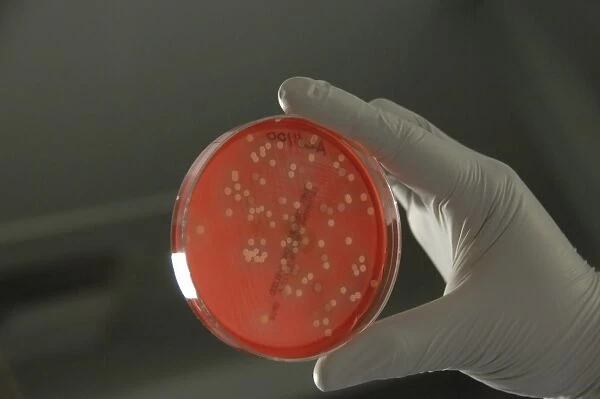 Bacteria from human skin grown on agar in the laboratory