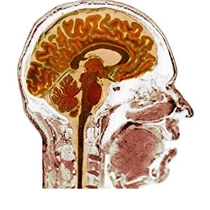 Normal human brain, MRI scan C016 / 8848