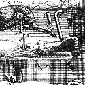 The techniques of blood transfusion from animal to man (top, fig. iv) and from man to man (bottom, fig. v). Copper engraving, 1667
